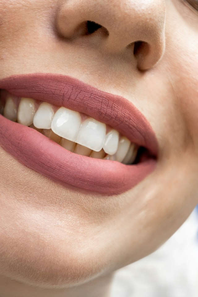 Sonrisa natural tras un tratamiento dental